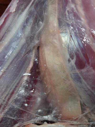 Bài 3. Các phương pháp điều trị Fascia thủ công