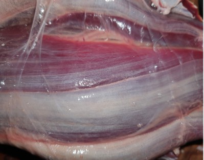 The link between fascia and chronic pain