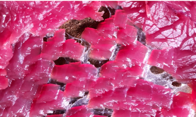WHAT IS FASCIA